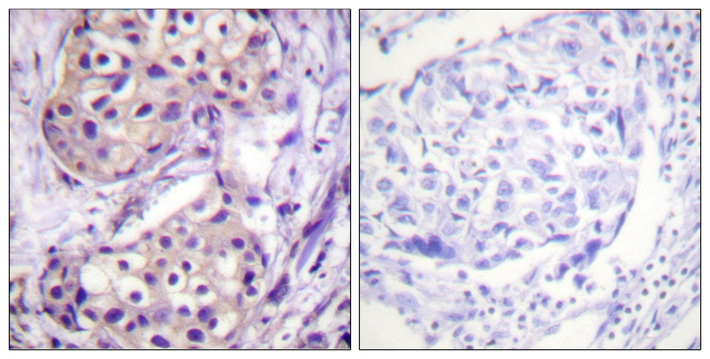 Polyclonal Rabbit anti-Human IKBKB / IKK2 / IKK Beta Antibody (IHC)