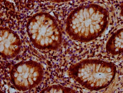 GLRX5 / Glutaredoxin 5 Antibody