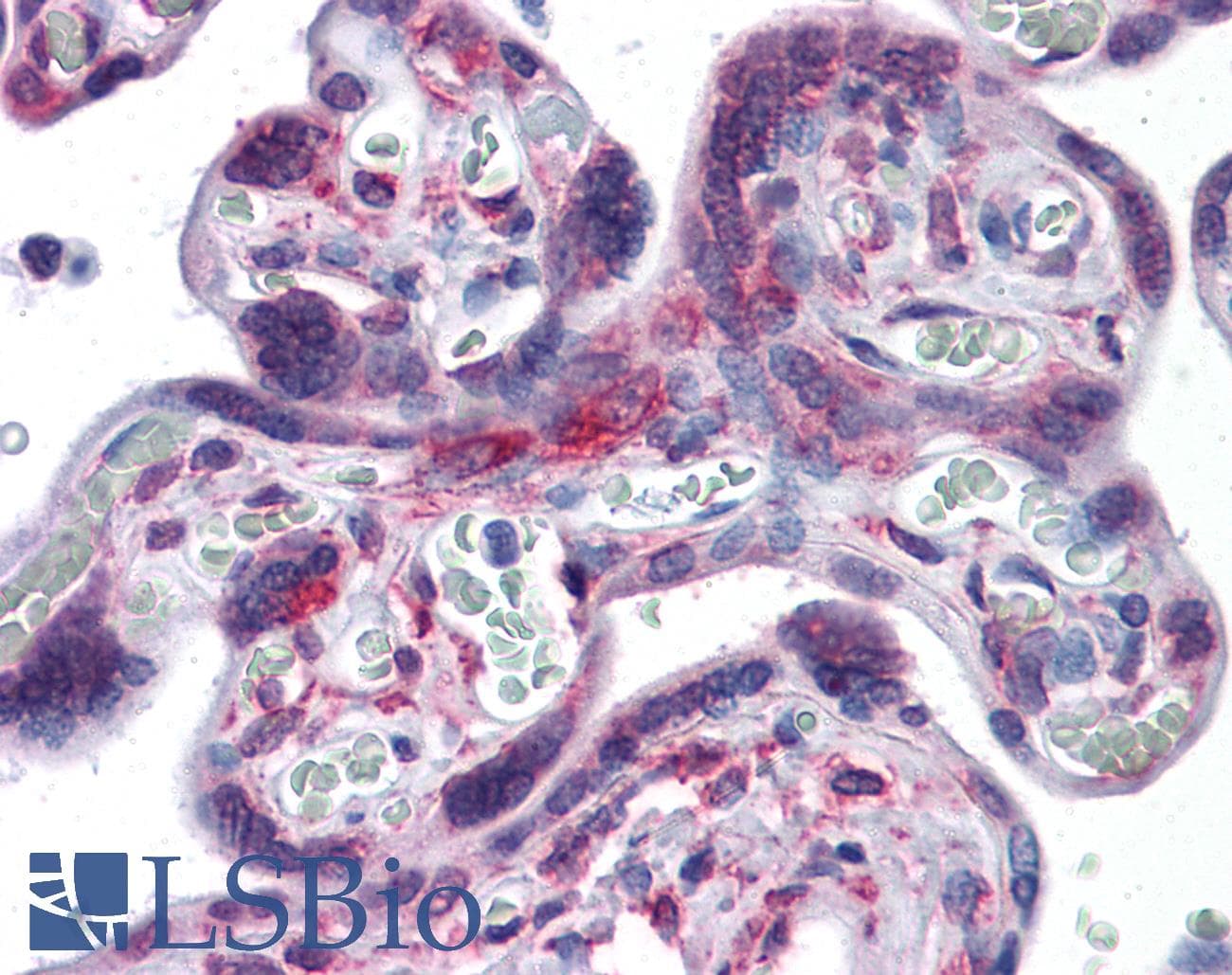 IHC-plus™ Monoclonal Mouse anti-Human RPS7 / Ribosomal Protein S7 Antibody (clone 3G4, IHC, IF, WB)