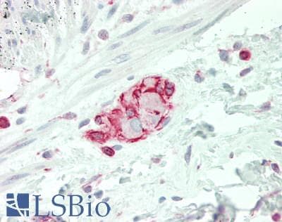 SLC38A3 / SNAT3 Antibody (aa31-80)