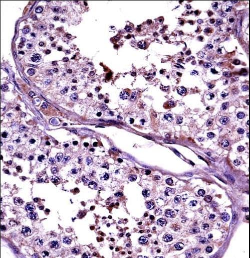 Polyclonal Rabbit anti-Human CTAG2 Antibody (aa122-149, IHC, WB)
