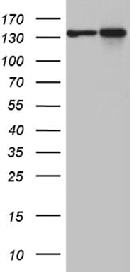 SMC1A / SMC1 Antibody (aa889-1016, clone OTI5A1)
