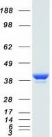 Human LDHA / LDH1 Protein (Recombinant Myc-DDK (Flag))