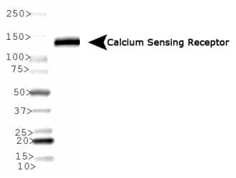 CASR/Calcium Sensing Receptor Antibody (N-Terminus, clone HL 1499, Biotin)
