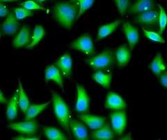 Polyclonal Rabbit anti-Human MYL3 Antibody (IF, WB)