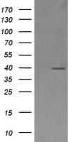 Monoclonal Mouse anti-Human MAP2K3 / MEK3 / MKK3 Antibody (clone OTI1H3, IHC, WB)