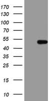 HMBS / PBGD Antibody (clone OTI1F1)