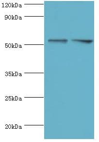 Polyclonal Rabbit anti-Human FKBP4 / FKBP52 Antibody (aa220-459, IHC, WB)