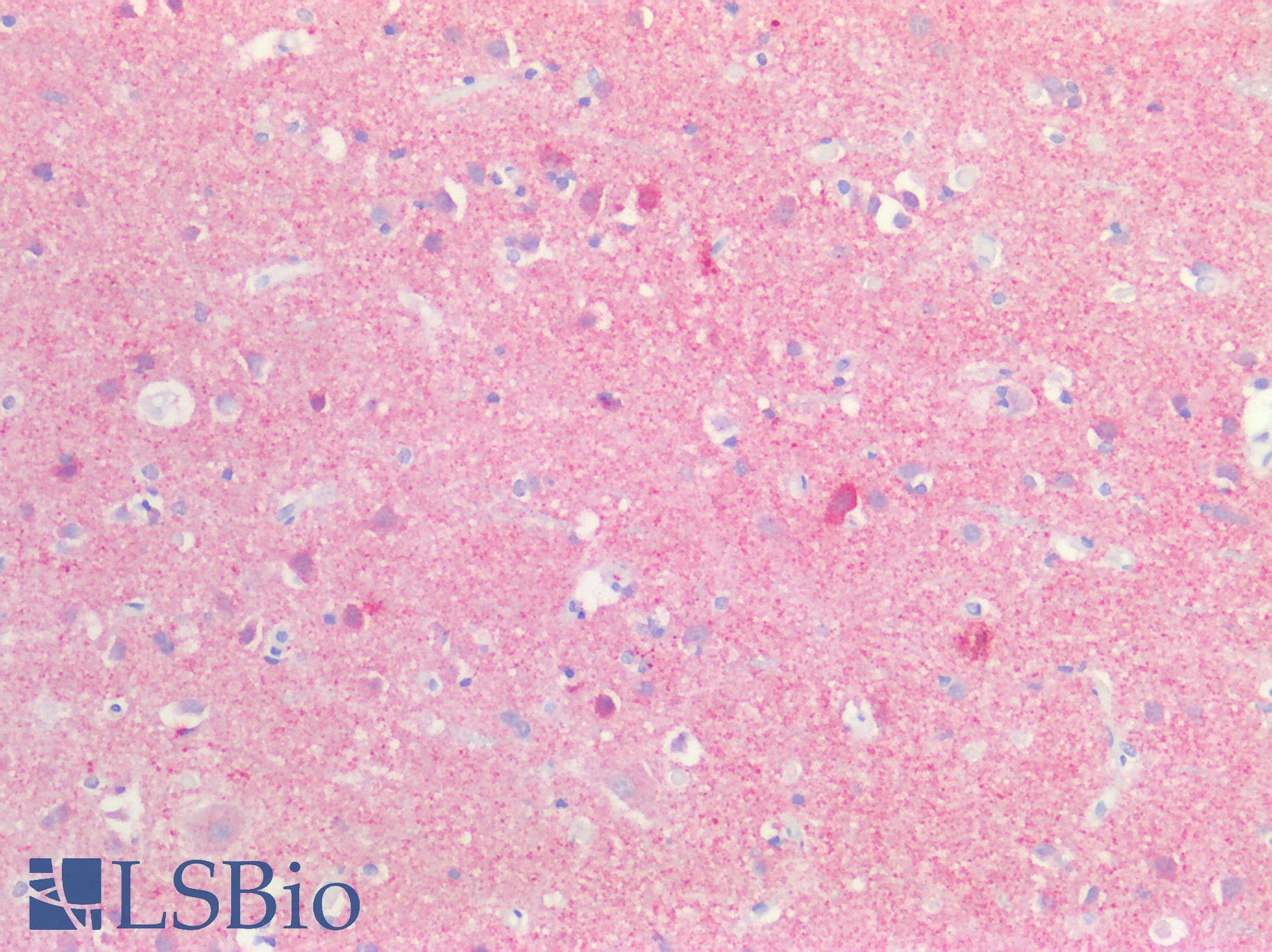 PathPlus™ SNCA / Alpha-Synuclein Antibody (N-Terminus)