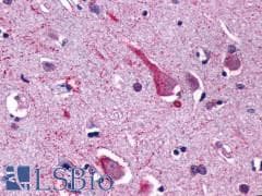PathPlus™ GPR137B Antibody (Cytoplasmic Domain)