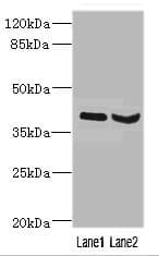 HOXD10 Antibody