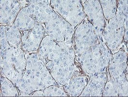 KIF2C / MCAK Antibody (clone OTI1C5)