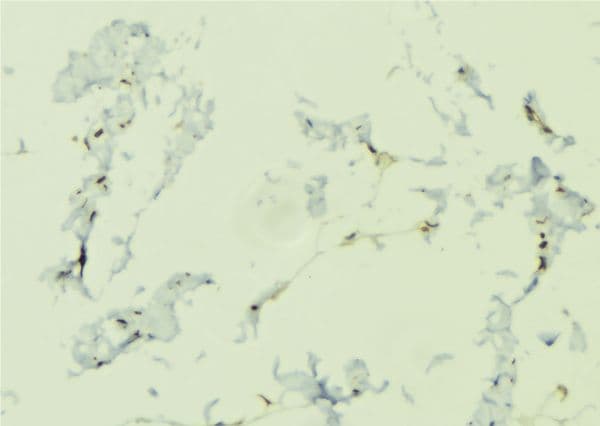 NOD1 Antibody