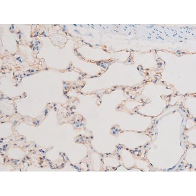 LIMK2 Antibody (phospho-Ser283)