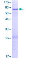 Human ZCCHC12 Protein (Recombinant GST)