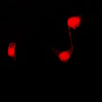 Polyclonal Rabbit anti-Human PPHLN1 Antibody (Internal, IHC, IF, WB)