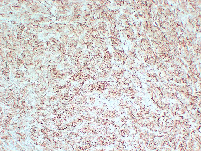PMEL / SILV / gp100 Antibody (clone ABT-PMEL)