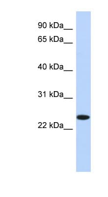 Polyclonal Rabbit anti-Human NKAIN4 / C20orf58 Antibody (N-Terminus, WB)