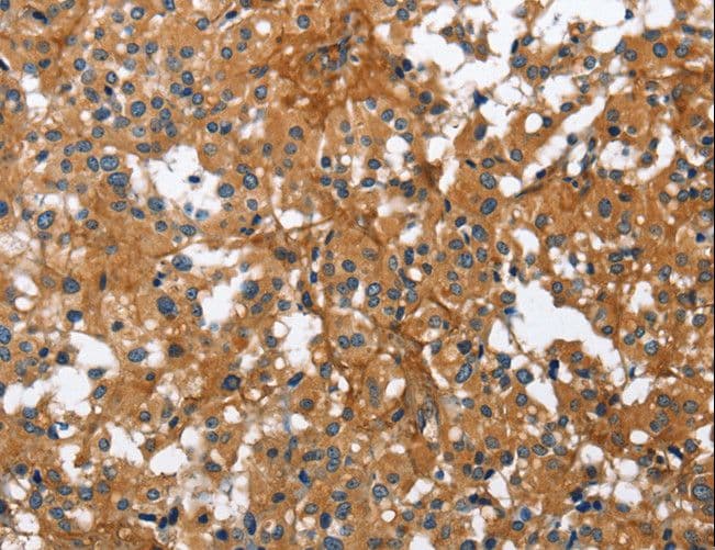 BGN / Biglycan Antibody