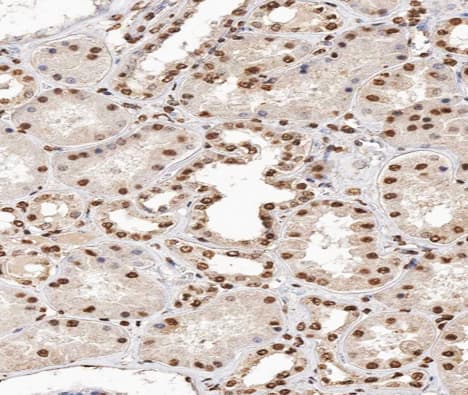 MAPK14 / p38 Antibody (phospho-Tyr182)