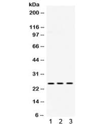 UCHL1 / PGP9.5 Antibody