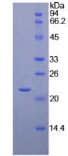 Chicken IFN Beta / Interferon Beta Protein (Recombinant His)