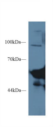 AMY1A / Salivary Amylase Antibody (aa16-511)