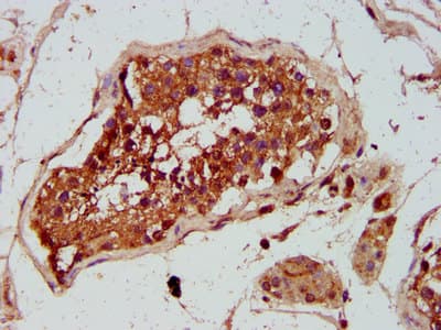 GREM1 / Gremlin-1 Antibody