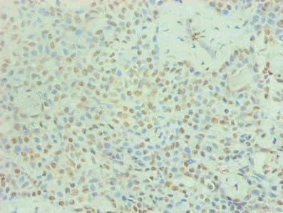Monoclonal Mouse anti-Human PRL / Prolactin Antibody (clone 4A2B3, IHC)