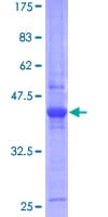 Human ETNK1 / Ethanolamine Kinase 2 Protein (Recombinant GST)