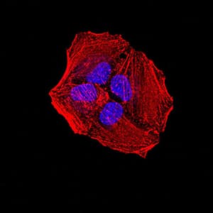 Monoclonal Mouse anti-Human ALK2 / ACVR1 Antibody (clone 2E2C11, IHC, WB)