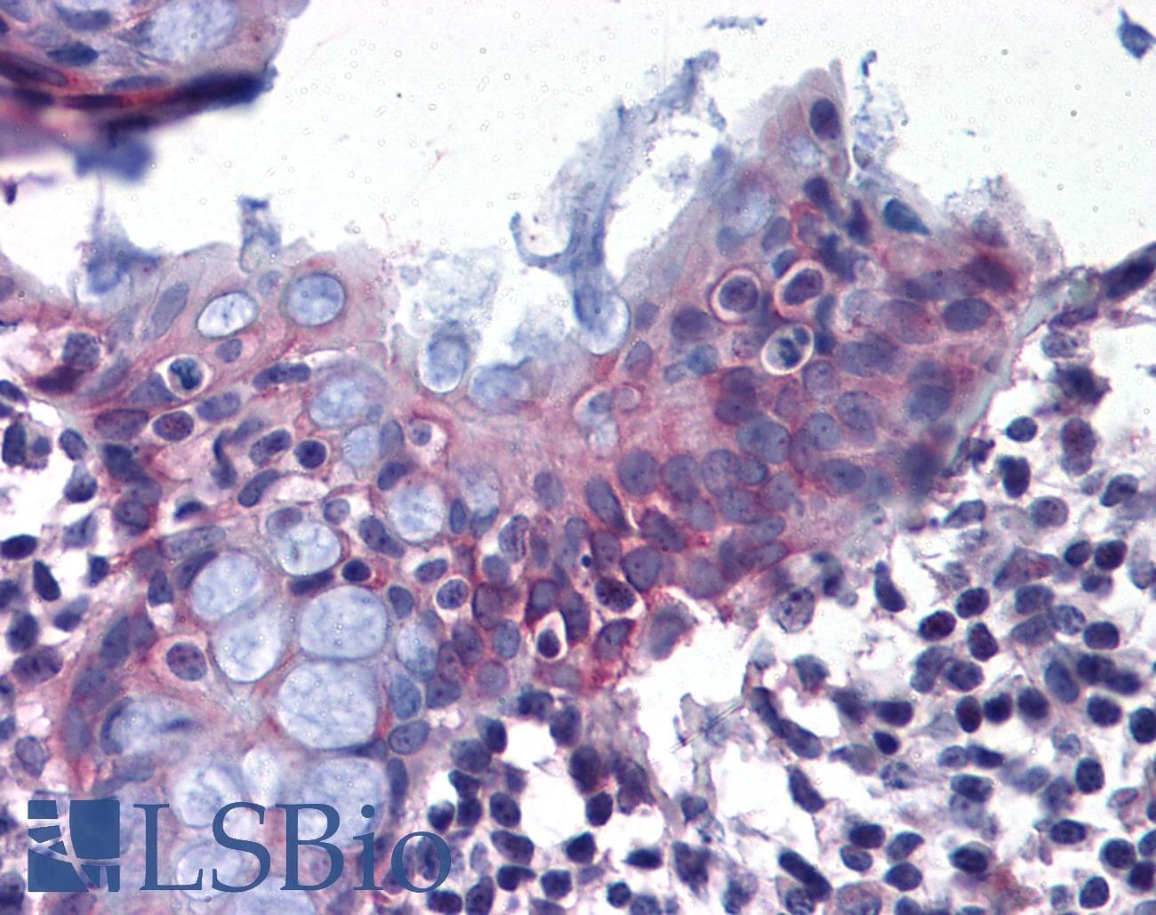 IHC-plus™ Polyclonal Rabbit anti-Human Renal Dipeptidase / DPEP1 Antibody (Internal, IHC)