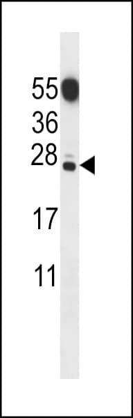 C20orf11 / TWA1 Antibody (aa44-72)