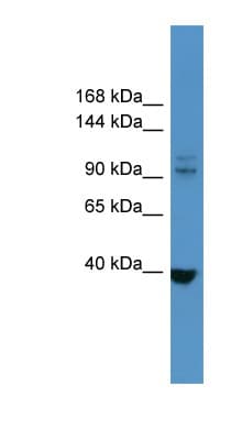 LTK Antibody (aa233-282)