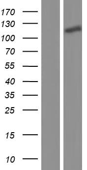 NXP2 / MORC3 Protein (Over-Expression Lysate Myc-DDK (Flag))