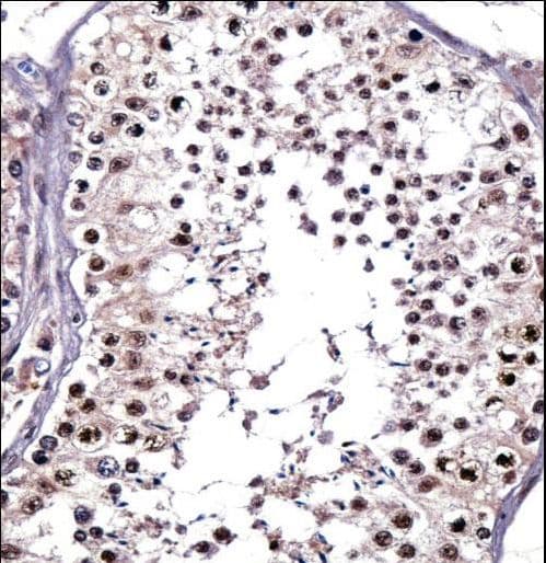 PTPRE / PTP Epsilon Antibody (aa134-163)