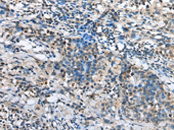 Polyclonal Rabbit anti-Human NDUFA12 / B17.2 Antibody (IHC, WB)