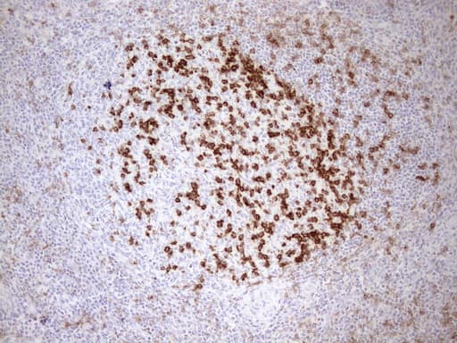 Monoclonal Mouse anti-Human PDCD1 / CD279 / PD-1 Antibody (clone UMAB198, Carrier-free, IHC, IF, WB)