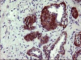 PDGFRB / PDGFR Beta Antibody (clone OTI1E8, Carrier-free)