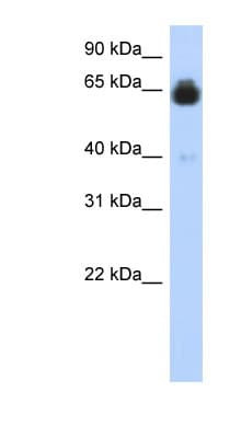 IGFALS / ALS Antibody (C-Terminus)