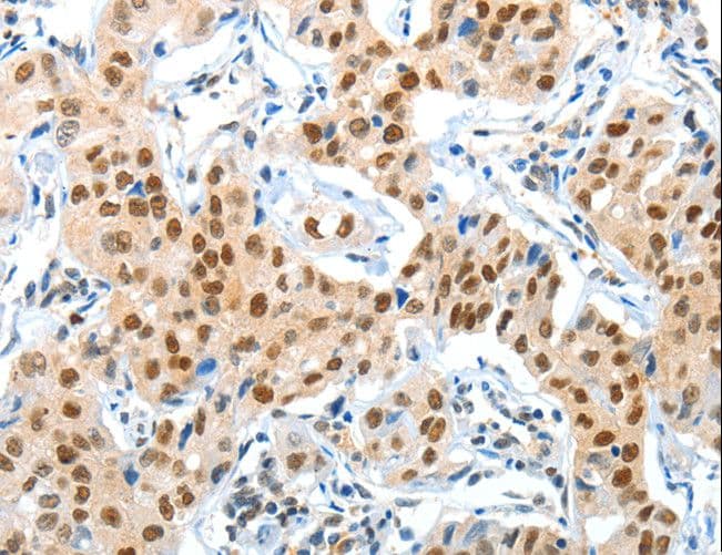 APPL1 / APPL Antibody