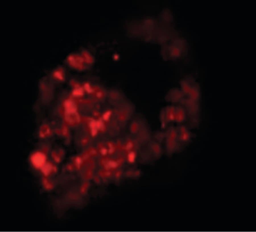 PRICKLE1 Antibody