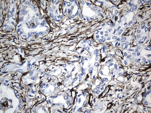 ACTA2 / Smooth Muscle Actin Antibody (N-Terminus, clone UMAB237)