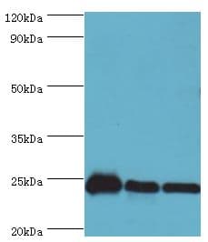 Polyclonal Rabbit anti-Human PPIB / Cyclophilin B Antibody (aa34-216, IHC, WB)