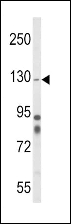 Polyclonal Rabbit anti-Human ITGA1/CD49a/Integrin Alpha 1 Antibody (aa727-755, IHC, WB)