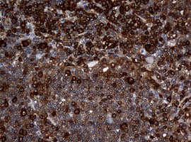Monoclonal Mouse anti-Human NME1 / NM23 Antibody (clone OTI7F2, IHC, WB)
