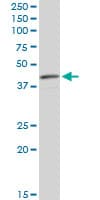 Monoclonal Mouse anti-Human CNN3 Antibody (clone 4C4, WB)
