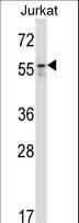 Polyclonal Rabbit anti-Human BECN1 / Beclin-1 Antibody (aa52-78, WB)
