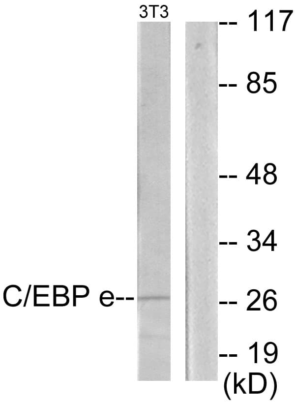 IHC-plus™ C/EBP Epsilon / CEBPE Antibody (aa191-240)