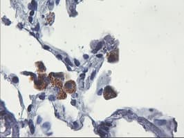 UBXN2B Antibody (clone OTI1F9)